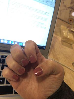 Shellac manicure after one week