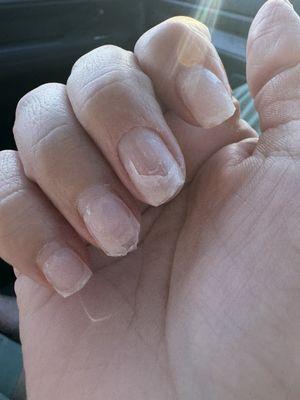 Ripped nail