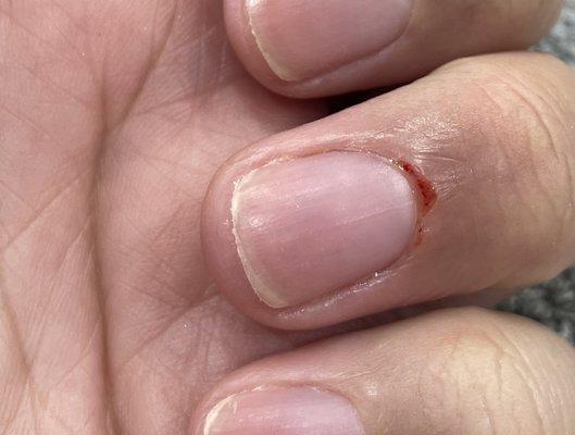 Manicure hurt so bad and still expected tip after. And full price. One thing is a small cut but a whole chunk of my skin?