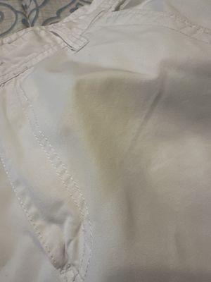 Yellow stains on white shorts