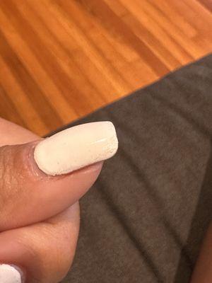 Top coat thats missing in the corner, causing nails to look bumpy.