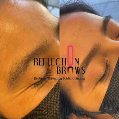 Brow shaping