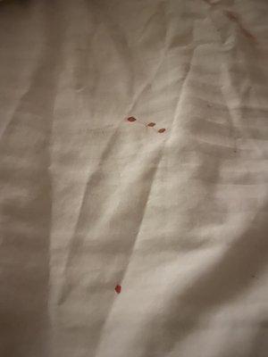 Bloody sheets (wtf?)