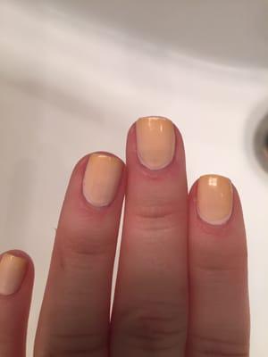 Beautiful yellow ombré, gross.