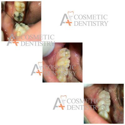 A Plus Cosmetic Dentistry