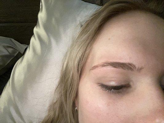 Right eyebrow