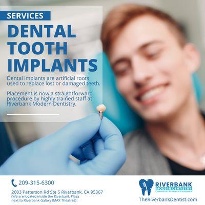 Tooth Implants at your near by Riverbank Dentist @ Riverbank Modern Dentistry.