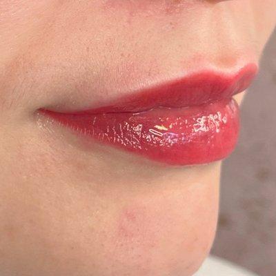 Lip blushing immediately following procedure