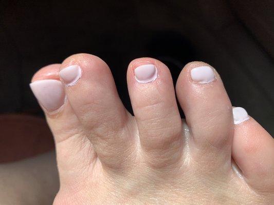 Bad gel pedicure!!