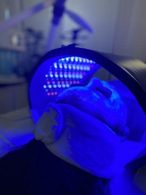 Celluma Blue Light Therapy kills bacteria and speeds up healing of acne.