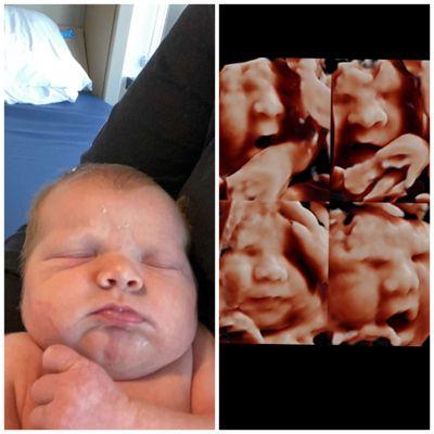 Newborn vs 34 week sonogram done by A New Image Baby