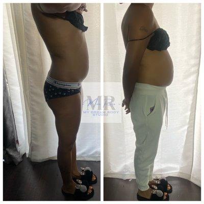 Stomach wrap with 30 min cavitation