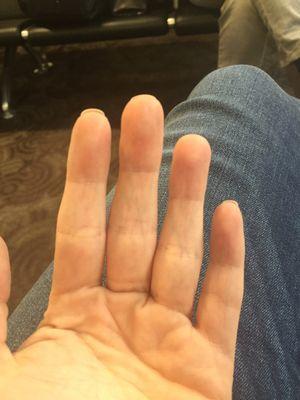 Varying lengths after having my nails "trimmed"