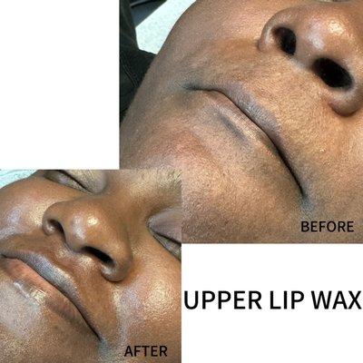 Upper Lip Wax