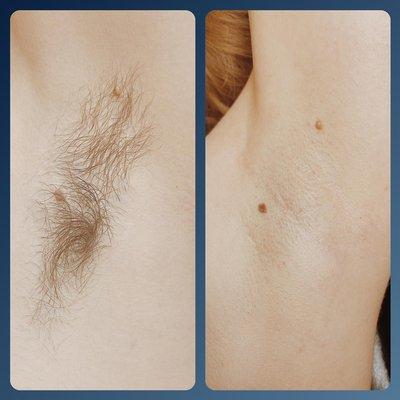 Underarm wax