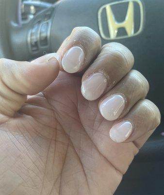 Horrible bumpy Thick nails