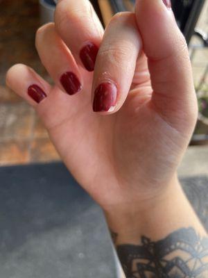 Chipped nails