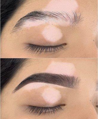 Brow Hybrid Tint on a Brow with Vitiligo