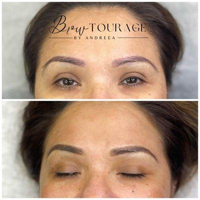 Brow Correction