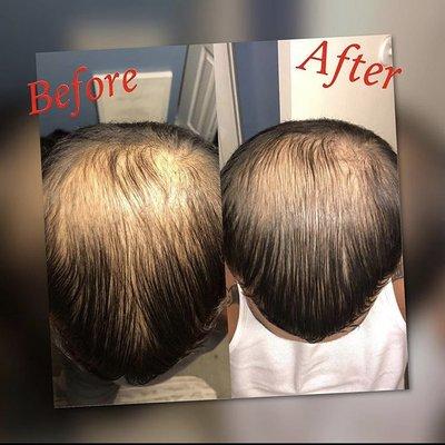 Before and After use of Essential Healing Stimulating Hair Growth Oil. 3 weeks