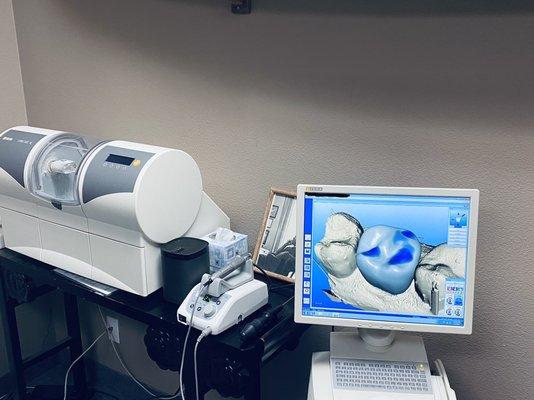 CEREC Technology: Computer Assisted Design for on site manufacturing to provide SINGLE VISIT CROWNS