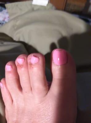 Toes ruined from hollywood nail salon countryside mall.