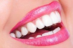 Teeth Whitening