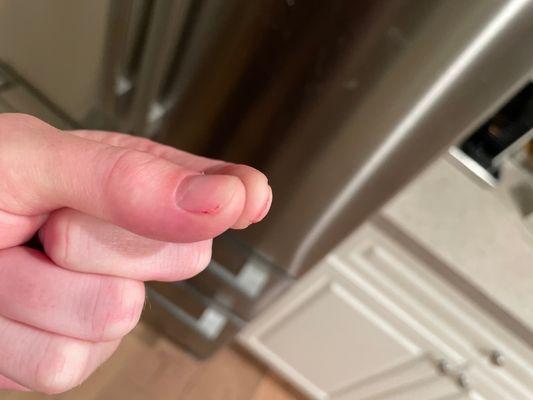 My pointer finger is where the nail was filed too short