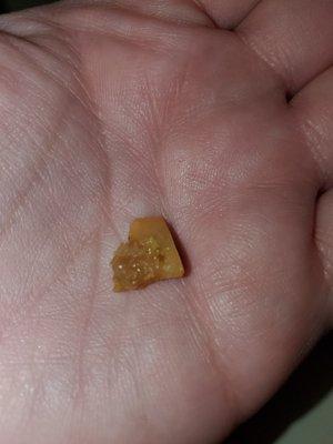 Bone shard found in food