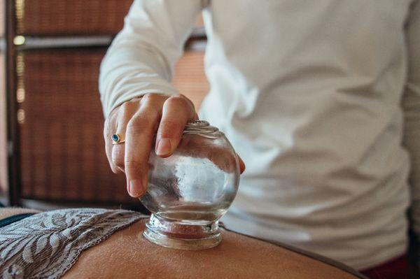 Cupping