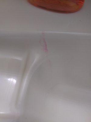 red stain on bathrrom basin