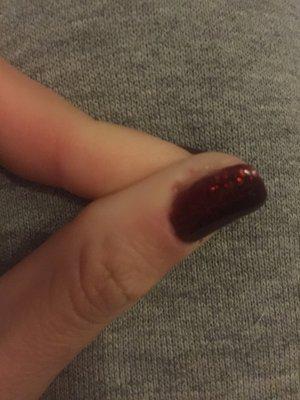 Bloody cuticles