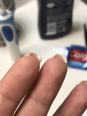 Did not clean the excess and underneath the nail