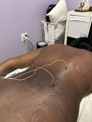 Electrostimulation