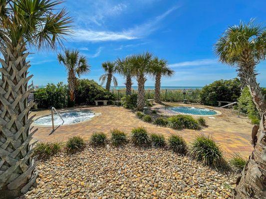 Outdoor hot tubs.