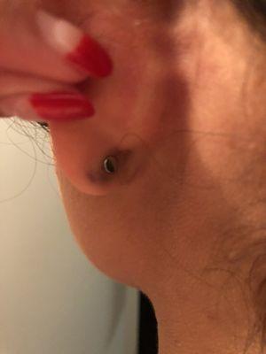 Left Ear lobe