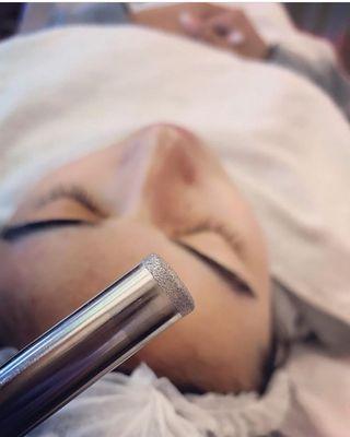 Microdermabrasion and chemical peels are a great way to maintain healthy clear skin