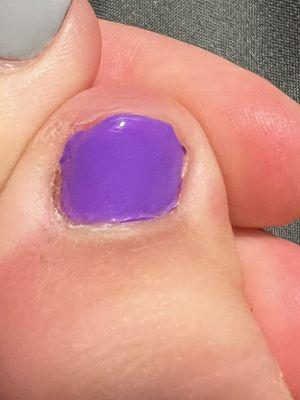 Paint on skin, polish bunched up at cuticle. Toes uneven.