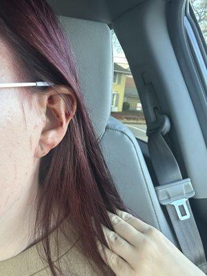 Hair dye left in my ears plus forehead after I left the salon.