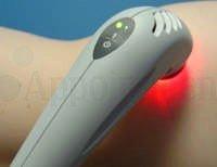 Cold Laser Pain Therapy