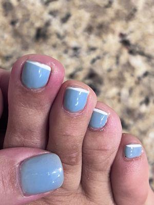 Infected toe in July 2023 after No chip manicure