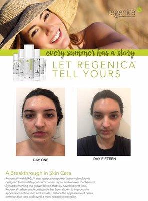 A Breakthrough in #Skincare!! #Regenica Tested On One Of Our Own (Before and After) #DrAventura #Aventura #Turnberry #MiamiBeach #Miami #Sun