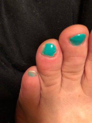 After 24 hours pedicure