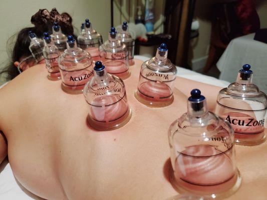 Thai Sports Massage And Spa cupping