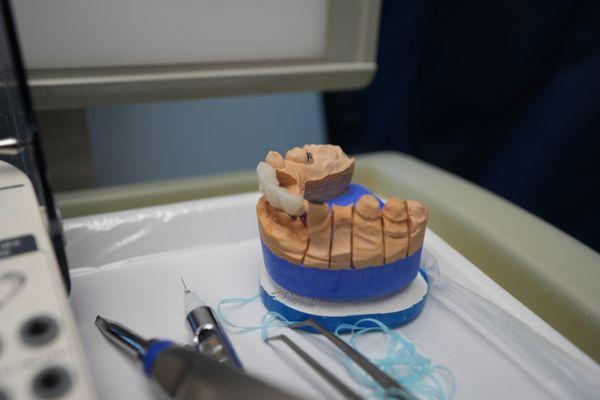 Dental implant impression