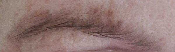 This is the wax left and hair on upper area of brow.