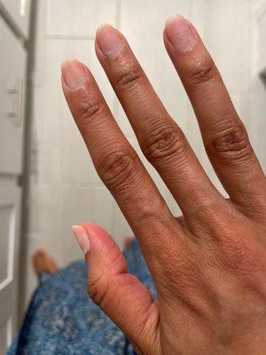 Dry, rough, scratched up nails after gel removal.