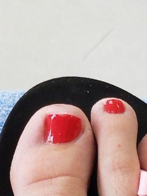 Looks like something chewed on my nails and ate away at it. Horrible place for pedicures.