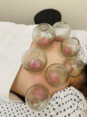 Cupping