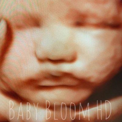 This beautiful HD LIVE baby ultrasound image was captured during the third trimester of pregnancy.  Look at those cheeks!